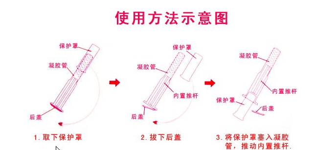 婦科凝膠使用方法示意圖