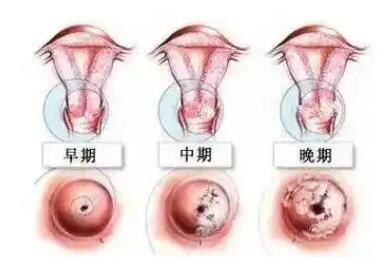 婦科凝膠oem廠家